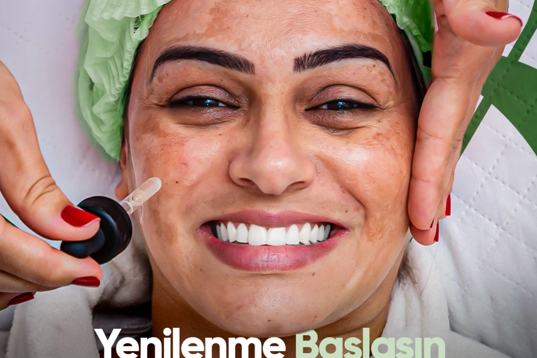 Proderma